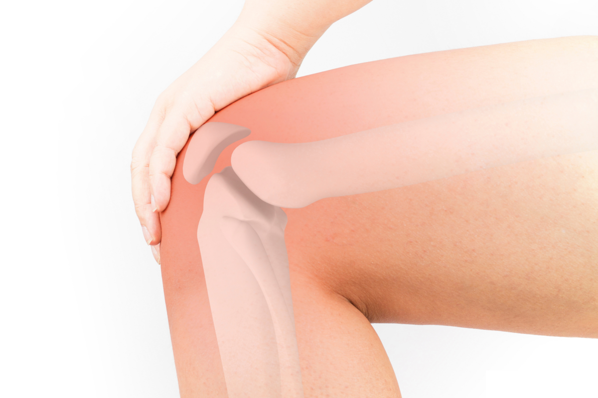 Ilustração em que se vê como são os ossos do joelho dentro da perna