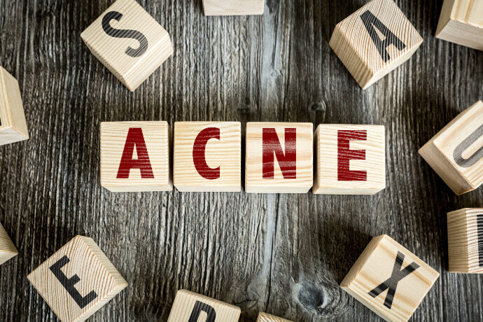 A palavra acne escrita em cubos de madeira